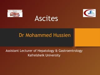 Ascites
Dr Mohammed Hussien
Assistant Lecturer of Hepatology & Gastroentrology
Kafrelsheik University
 