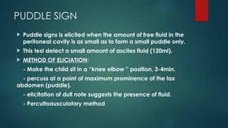 Normal Pudding Sign ASCITES IN CHILDREN. powerpointpresentation | PPTX