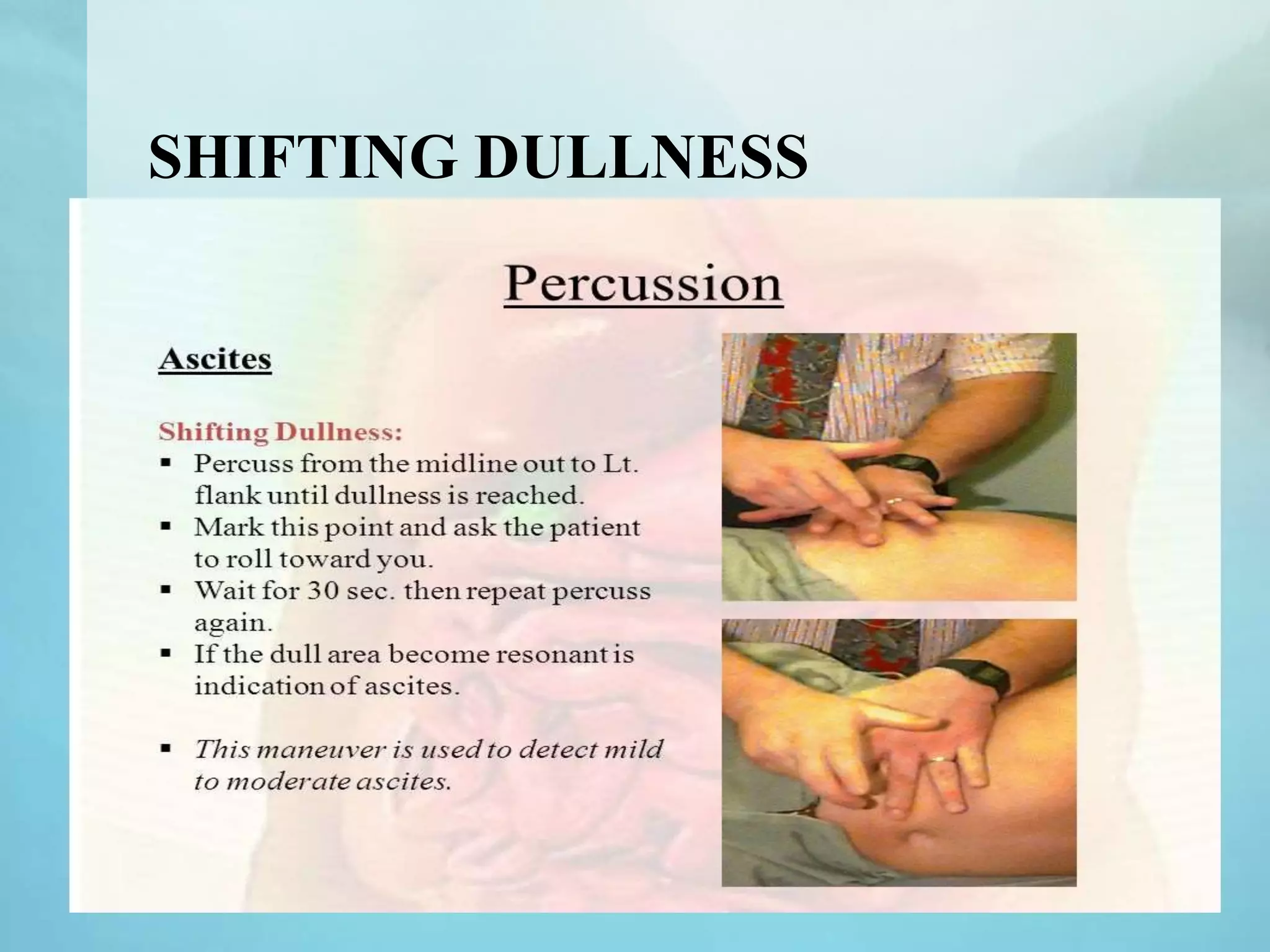 Ascites Ppts PPTX
