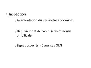 • Inspection
ₒ Augmentation du périmètre abdominal.
ₒ Déplissement de l’ombilic voire hernie
ombilicale.
ₒ Signes associés fréquents : OMI
 