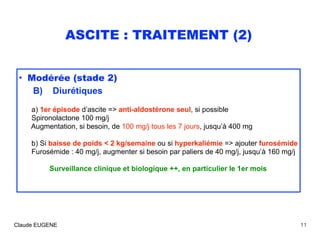 ASCITE : TRAITEMENT (2)
• Modérée (stade 2) 
B) Diurétiques 
 
a) 1er épisode d’ascite => anti-aldostérone seul, si possib...