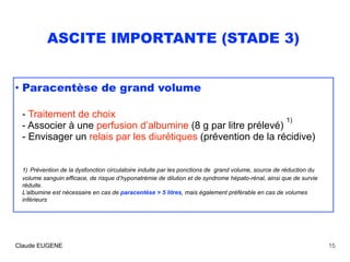 ASCITE IMPORTANTE (STADE 3)
• Paracentèse de grand volume 
 
- Traitement de choix 
- Associer à une perfusion d’albumine ...