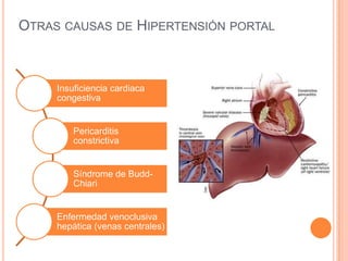 Por enfermedades del peritoneoAumento de permeabilidad del peritoneoExudado desde capilares del peritoneoObstrucción del drenaje linfático NeoplasiaInfecciónInflamación