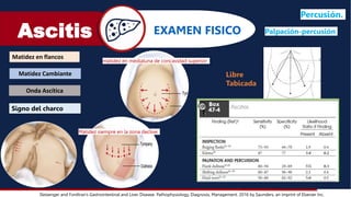 Ascitis
Sleisenger and Fordtran’s Gastrointestinal and Liver Disease: Pathophysiology, Diagnosis, Management. 2016 by Saunders, an imprint of Elsevier Inc.
EXAMEN FISICO
Matidez en flancos
Matidez Cambiante
Onda Ascítica
Percusión.
Libre
Tabicada
matidez en medialuna de concavidad superior
Matidez siempre en la zona declive.
Palpación-percusión
Signo del charco
 