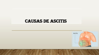 CAUSAS DE ASCITIS
