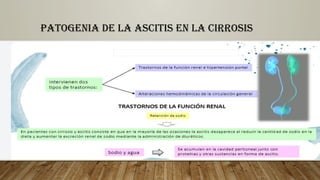 PATOGENIA DE LA ASCITIS EN LA CIRROSIS