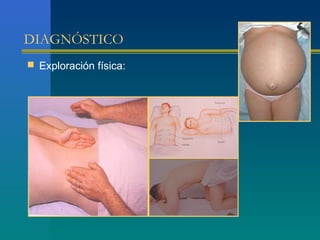 DIAGNÓSTICO
 Exploración física:
 