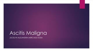 Ascitis Maligna
JOCELYN ALEJANDRA MERCADO SOSA
 