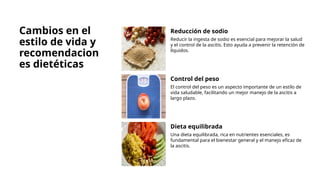 Cambios en el
estilo de vida y
recomendacion
es dietéticas
Reducción de sodio
Reducir la ingesta de sodio es esencial para mejorar la salud
y el control de la ascitis. Esto ayuda a prevenir la retención de
líquidos.
Control del peso
El control del peso es un aspecto importante de un estilo de
vida saludable, facilitando un mejor manejo de la ascitis a
largo plazo.
Dieta equilibrada
Una dieta equilibrada, rica en nutrientes esenciales, es
fundamental para el bienestar general y el manejo eficaz de
la ascitis.
 