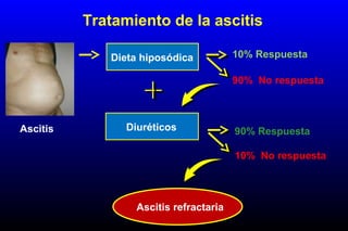 Tratamiento de la ascitis
Dieta hiposódica 10% Respuesta
90% No respuesta
Diuréticos 90% Respuesta
10% No respuesta
Ascitis refractaria
Ascitis
 