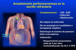 Anastomosis peritoneovenosa en la
ascitis refractaria
Válvula uni-
direccional
PERITONEO-VENOUS SHUNT (PVS) IS USEFUL IN THE TREATMENT OF REFRACTORY ASCITES
• Complicaciones: - CID - EAP
- Infección
- Obstrucción
• No mejora la sobrevida
• No se aconseja en candidatos a
transplante hepático
• Disminuye el número de paracen-
tesis evacuadoras
• Indicación:
- Requerimiento paracentesis
(más de 3 por mes)
- Contraindicación de OLT ó TIPS
 