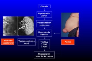 Cirrosis
Hipertensión
portal
Vasodilatación
esplácnica
Hipovolemia
efectiva
↑ SRAA
↑ SNS
↑ ADH
Reabsorción
renal de Na y agua
Vasoconstricción
renal
Ascitis
Síndrome
hepatorenal
 