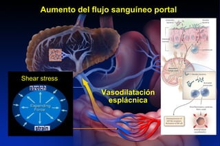 AN INCREASE IN PORTAL VENOUS INFLOW SUSTAINS PORTAL HYPERTENSION
Vasodilatación
esplácnica
Aumento del flujo sanguíneo portal
Venas
mesentéricas
Vena
porta
Shear stress
 