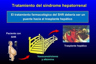 Tratamiento del síndrome hepatorrenal
El tratamiento farmacológico del SHR debería ser un
puente hacia el trasplante hepático
Paciente con
SHR
Trasplante hepático
Vasoconstrictores
y albúmina
 