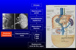 Cirrosis
Hipertensión
portal
Vasodilatación
esplácnica
Hipovolemia
efectiva
↑ SRAA
↑ SNS
↑ ADH
Reabsorción
renal de Na y agua
Vasoconstricción
renal
Ascitis
Síndrome
hepatorenal
 