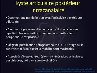 Predilection Def as cliniques rachis cervical - 50 dossiers à ne pas manquer.pdf