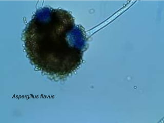 Aspergillus flavus

 