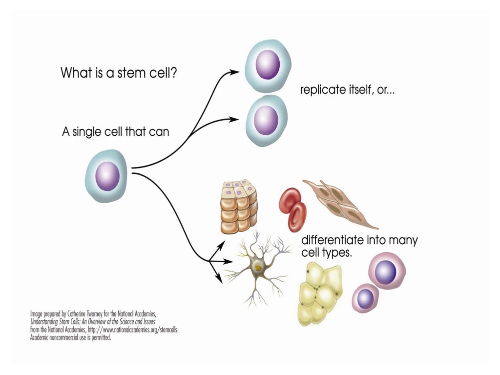 autologous bone marrow transplant