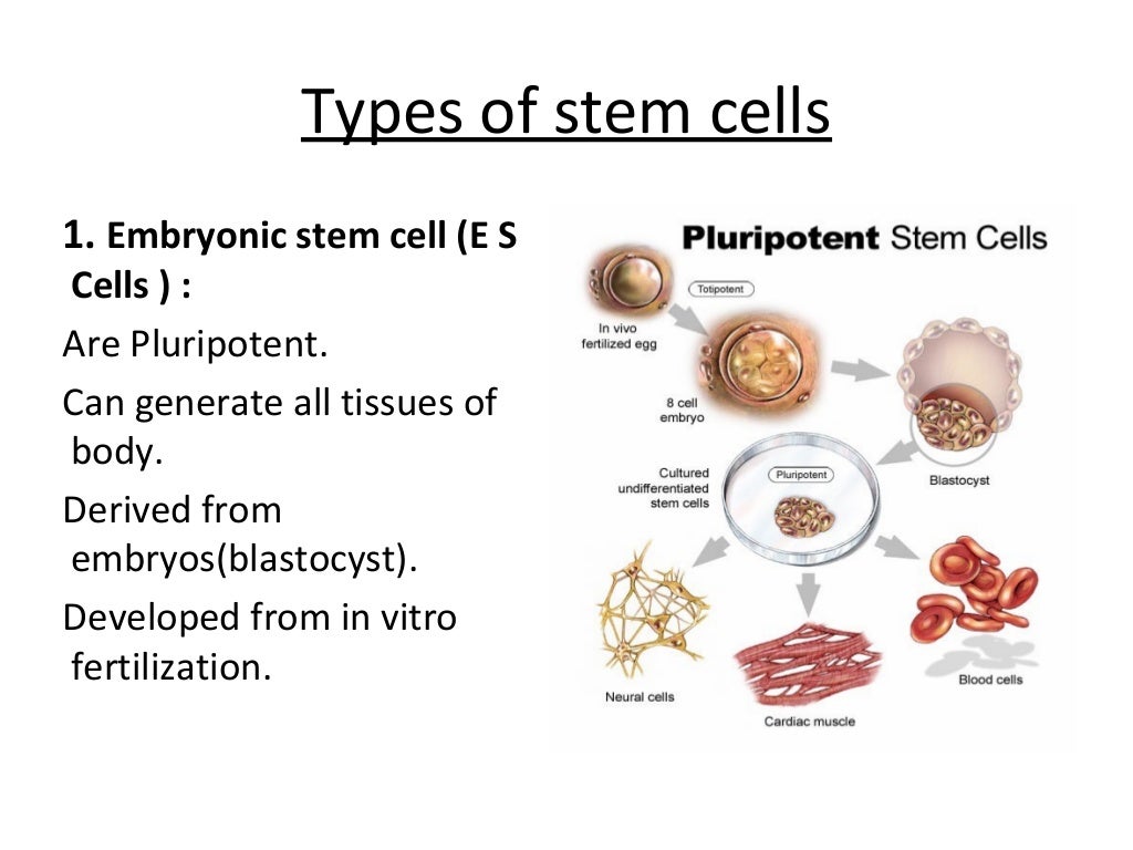 autologous bone marrow transplant