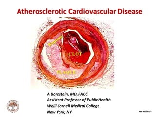 ABB MD FACC©
Atherosclerotic Cardiovascular Disease
A Bornstein, MD, FACC
Assistant Professor of Public Health
Weill Cornell Medical College
New York, NY
 