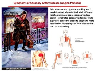 ABB MD FACC©
Symptoms of Coronary Artery Disease (Angina Pectoris)
Cold weather and cigarette smoking are 2
precipitants of a heart attack via 2 different
mechanisms: cold causes coronary artery
spasm (constricted coronary arteries), while
cigarettes cause the blood to coagulate more
readily thus increasing clot formation within
the coronary artery.
 