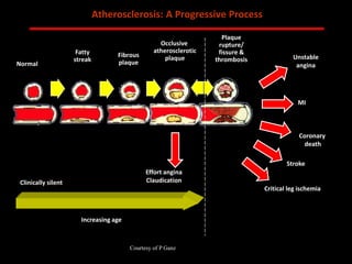 ABB MD FACC©
Normal
Fatty
streak
Fibrous
plaque
Occlusive
atherosclerotic
plaque
Plaque
rupture/
fissure &
thrombosis
Clinically silent
Increasing age
Effort angina
Claudication
MI
Unstable
angina
Coronary
death
Stroke
Critical leg ischemia
Atherosclerosis: A Progressive Process
Courtesy of P Ganz
 