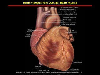 ABB MD FACC©
Heart Viewed From Outside: Heart Muscle
By Patrick J. Lynch, medical illustrator https://creativecommons.org/licenses/by/2.5
 