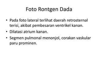 Foto Rontgen Dada 
• Pada foto lateral terlihat daerah retrosternal 
terisi, akibat pembesaran ventrikel kanan. 
• Dilatasi atrium kanan. 
• Segmen pulmonal menonjol, corakan vaskular 
paru prominen. 
 