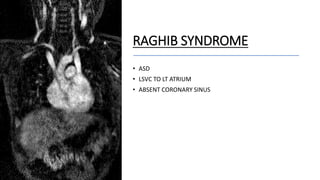 RAGHIB SYNDROME
• ASD
• LSVC TO LT ATRIUM
• ABSENT CORONARY SINUS
 