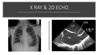 X RAY & 2D ECHO
 