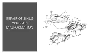 REPAIR OF SINUS
VENOSUS
MALFORMATION
 