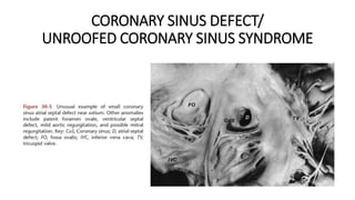 CORONARY SINUS DEFECT/
UNROOFED CORONARY SINUS SYNDROME
 