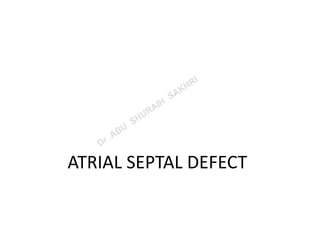 ATRIAL SEPTAL DEFECT
 