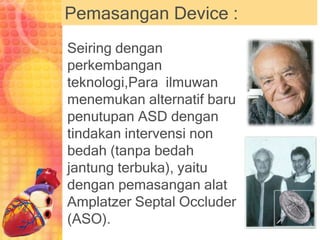Pemasangan Device :
Seiring dengan
perkembangan
teknologi,Para ilmuwan
menemukan alternatif baru
penutupan ASD dengan
tindakan intervensi non
bedah (tanpa bedah
jantung terbuka), yaitu
dengan pemasangan alat
Amplatzer Septal Occluder
(ASO).
 