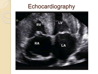 Echocardiography
 