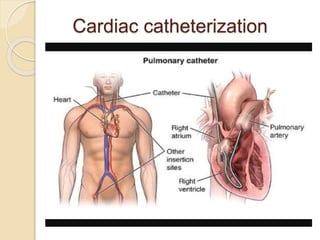Cardiac catheterization
 