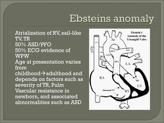  Atrialization of RV, sail-like
TV,TR
 50% ASD/PFO
 50% ECG evidence of
WPW
 Age at presentation varies
from
childhoodadulthood and
depends on factors such as
severity of TR, Pulm
Vascular resistance in
newborn, and associated
abnormalities such as ASD
 