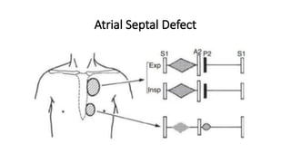 ASD AND VSD (1).pptx ATRIAL SEPTAL DEFECT AND VENTRICULAR SEPTAL DEFECT ...