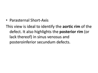 Partial Peripheral Rim Defect Asd echo assessment | PPTX