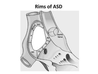 Ase Asd Rims ASD ECHO ASSESSMENT renewed slideshow.pptx