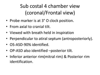 ASD ECHO ASSESSMENT renewed slideshow.pptx