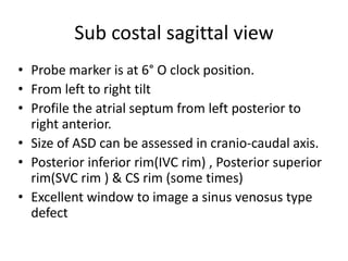 Measure Rims Asd Mri ASD ECHO ASSESSMENT renewed slideshow.pptx