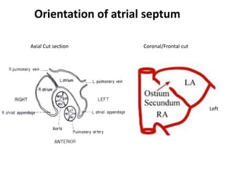ASD ECHO ASSESSMENT renewed slideshow.pptx