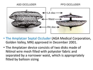 Atrial Septal Defect | PPTX