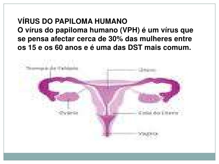 Bem como do que aumentar uma potência