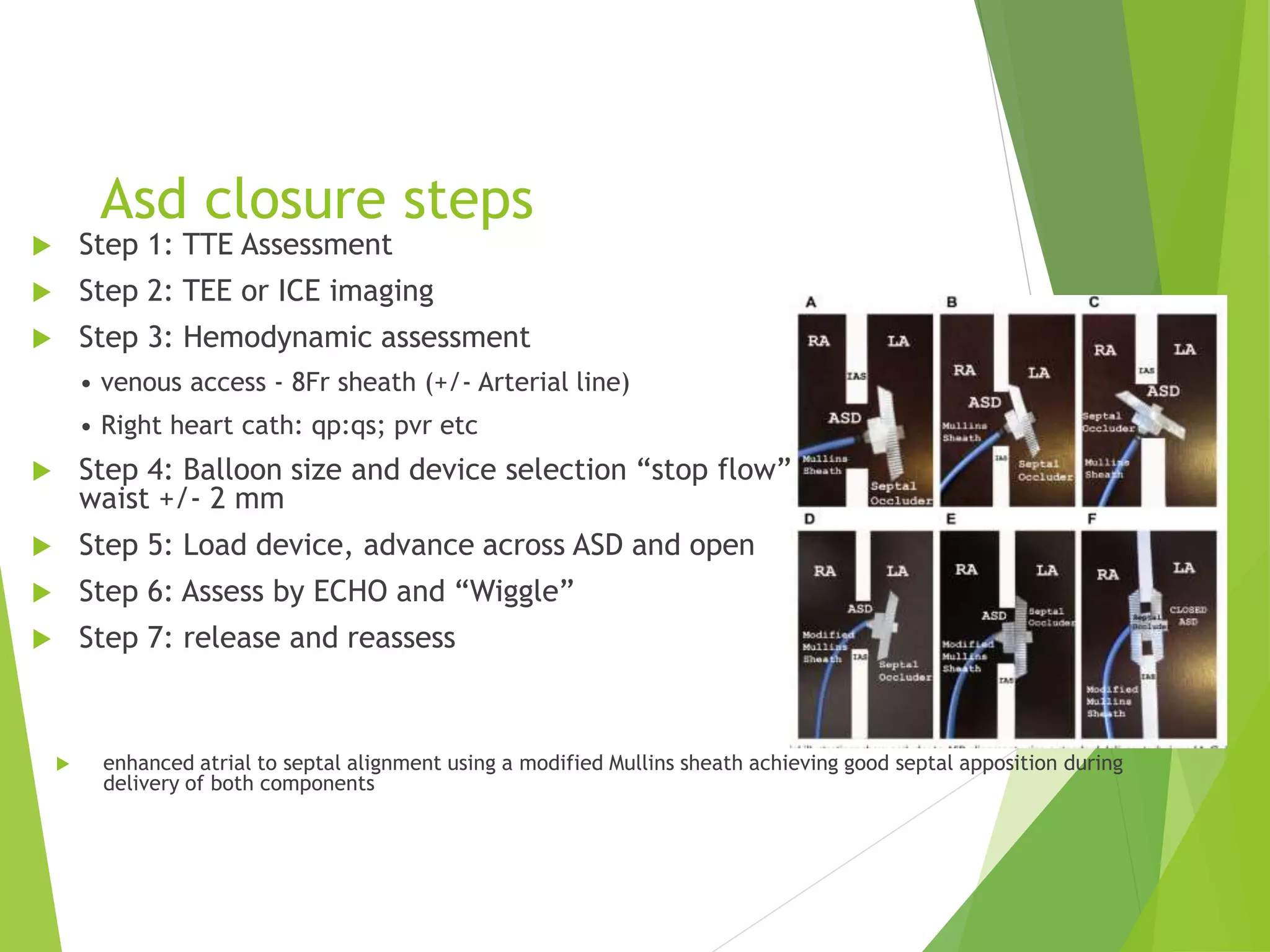 Asd closure steps
 Step 1: TTE Assessment
 Step 2: TEE or ICE imaging
 Step 3: Hemodynamic assessment
• venous access - 8Fr sheath (+/- Arterial line)
• Right heart cath: qp:qs; pvr etc
 Step 4: Balloon size and device selection “stop flow”
waist +/- 2 mm
 Step 5: Load device, advance across ASD and open
 Step 6: Assess by ECHO and “Wiggle”
 Step 7: release and reassess
 enhanced atrial to septal alignment using a modified Mullins sheath achieving good septal apposition during
delivery of both components
 
