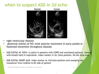 when to suspect ASD in 2d echo
SEYYED REZA MIRI.MD, Pediatric Cardiologist, Interventionist 16
• right ventricular dilation
• abnormal motion of IVS: brisk anterior movement in early systole or
flattened movement throughout diastole
• SUB COSTAL 4C VIEW- is useful in patients with COPD and ventilated patients, viewed
with breath held in inspiration- index marker in 3o' clock position. No IAS drop outs
• SUB COSTAL SHORT AXIS- Index marker at 12o'clock position and sweeping the
transducer from midline to Rt side of patient
 