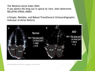 SEYYED REZA MIRI.MD, Pediatric Cardiologist, Interventionist 17
The Relative Atrial Index (RAI)
If you detect IAS drop out in apical 4c view ,then determine
RELATIVE ATRIAL INDEX
A Simple, Reliable, and Robust Transthoracic Echocardiographic
Indicator of Atrial Defects
 