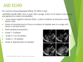 ASD ECHO
SEYYED REZA MIRI.MD, Pediatric Cardiologist, Interventionist 19
For contrast echocardiography APICAL 4C VIEW is used
AGITATED SALINE USED- 5m1 in each 10m1 syringe. 0.5m1 of air taken in the syringe
and agitated to create microbubbles.
 arrow shows negative contrast effect ,a direct evidence of shunt(non contrast
blood in RA)
 Extent of shunting tend to focus on numbers of bubbles seen in a single still
frame in the left atrium.
 Shunt grading incorporates :
 Grade 1: 5 bubbles
 Grade 2: 5 to 25 bubbles
 Grade 3: >25 bubbles
 Grade 4: Opacification of chamber
 