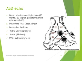ASD echo
1. Detect size from multiple views (SC
frontal, SC sagital, parasternal short
axis, apical 4C )
2. Determine Total Septal length
3. Determine the Rims:
 Mitral Valve (apical 4c)
 Aortic (PS short)
 SVC / pulmonary veins
SEYYED REZA MIRI.MD, Pediatric Cardiologist, Interventionist 20
 